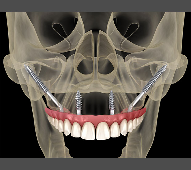 Norwalk Oral Surgeon